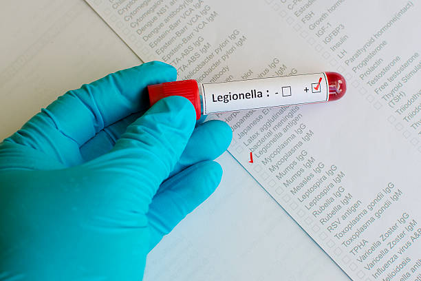 Is Legionella check a legal requirement in UK