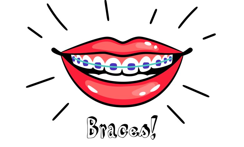 braces penang