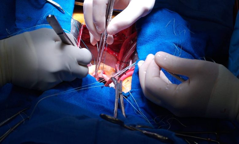 Heart Surgery Doctor in India